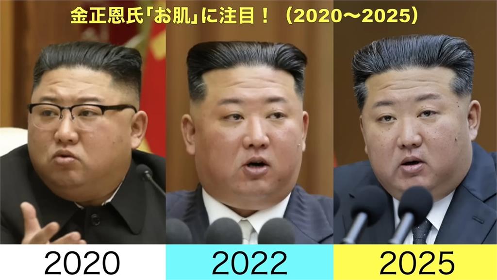 金正恩「無修圖照」爆健康疑雲!臉上長滿「詭異肉芽」10年前對比照曝光