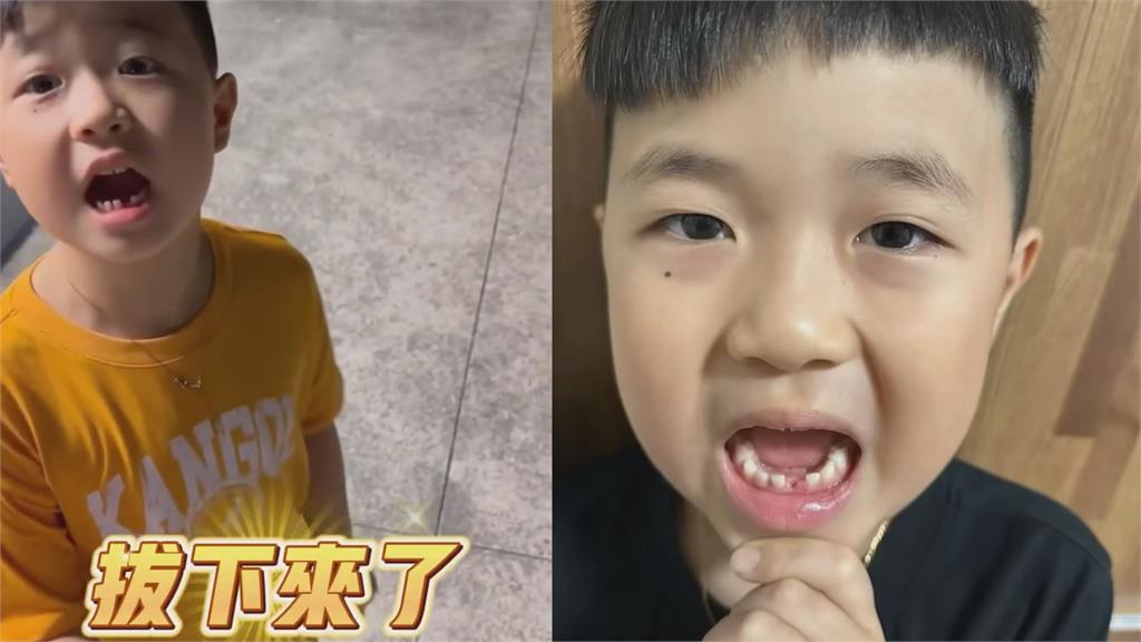 爸出奇招幫7歲兒拔乳牙 「線綁機車並發動」結果驚呆網:第一次看到