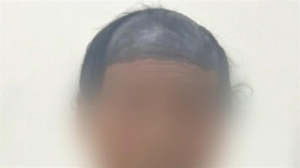 奇異筆「塗黑頭頂」當假髮 禿頭男偷超市火鍋料遭逮