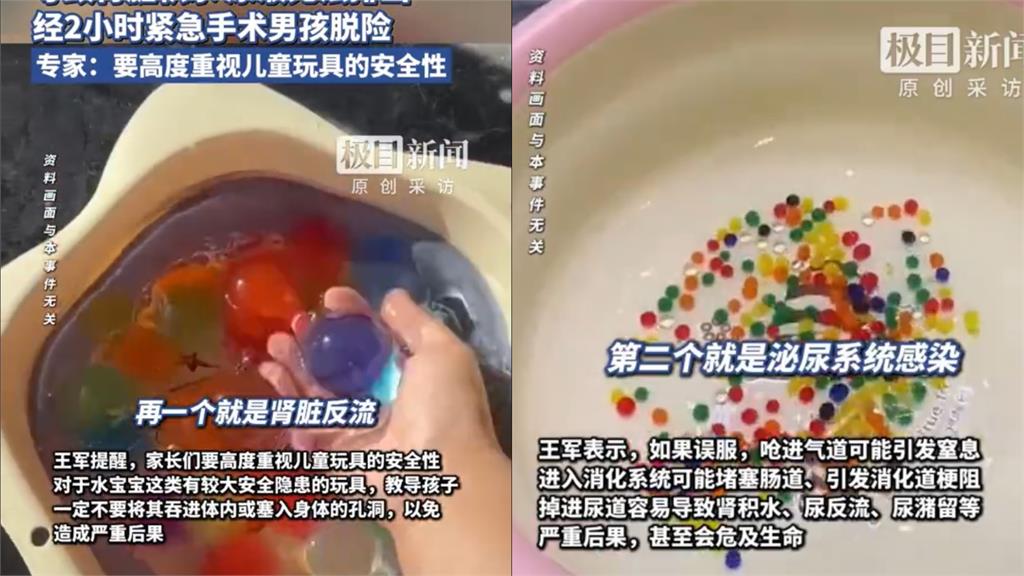 好奇釀大禍!14歲少年喊:膀胱要炸了…竟是「尿道塞38顆水晶寶寶」
