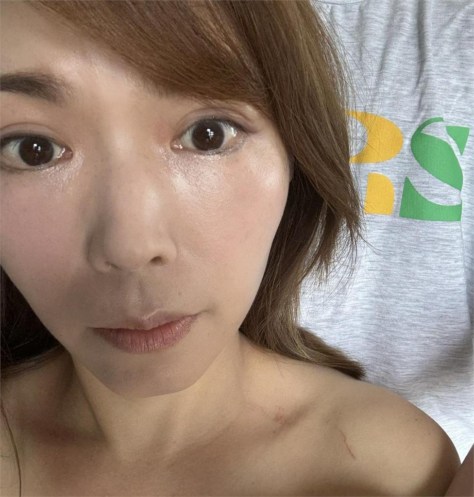 陳智菡竟喊「太熱想找樹蔭乘涼」才爬拒馬!PO抓痕照嗆警察:要辦就來