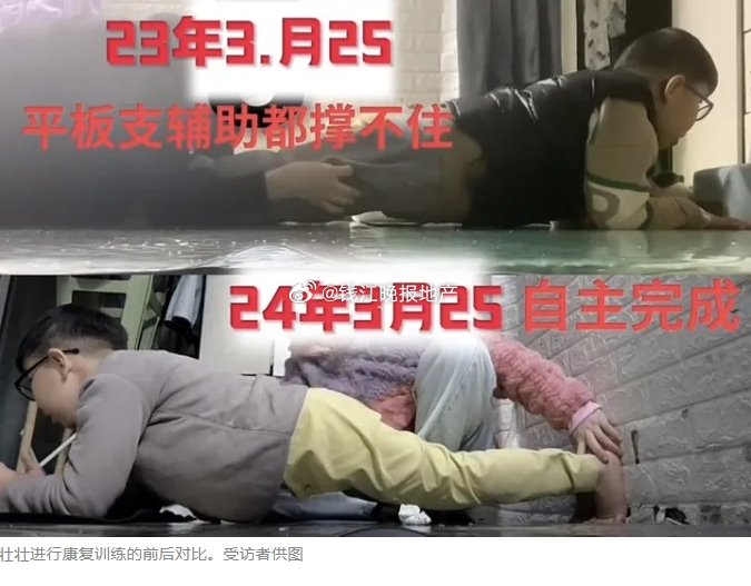 9歲腦麻兒突起身行走!父故作冷靜「不忍打擾」偷拭淚 惹哭百萬網友