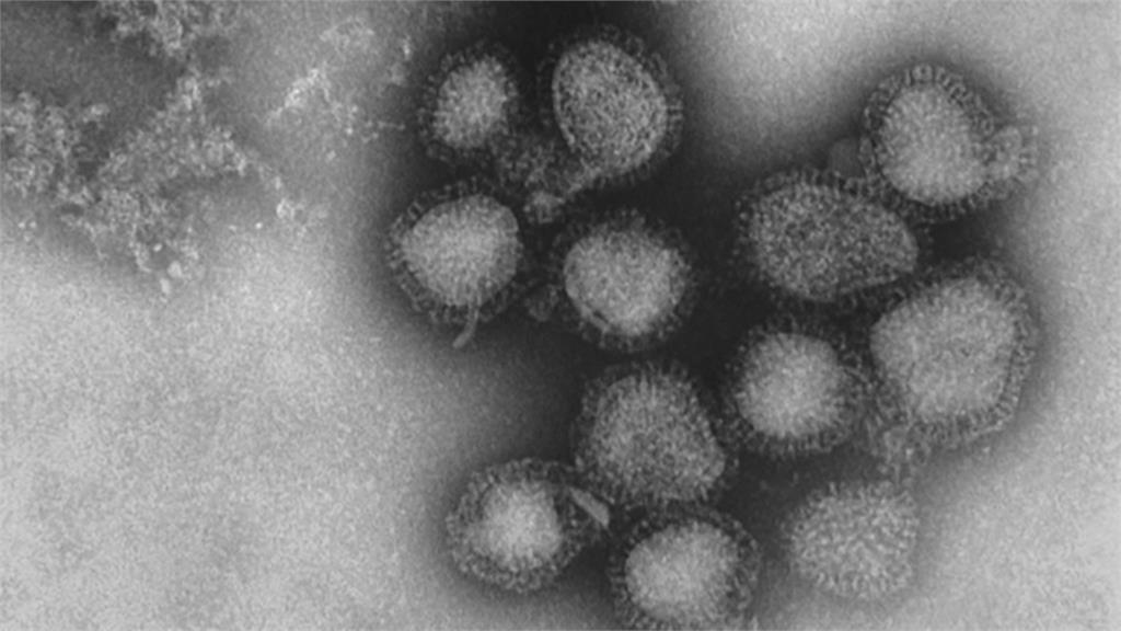 美流感疫情1500萬人感染　7400死、約18萬人住院