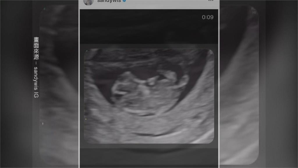 曬超音波影片、與老公合照　吳姍儒宣布懷孕5個月喜訊