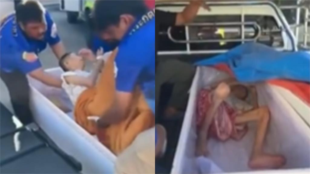 65歲婦人「死而復生」狂敲棺材！親弟激動流淚：差一點就送去火化
