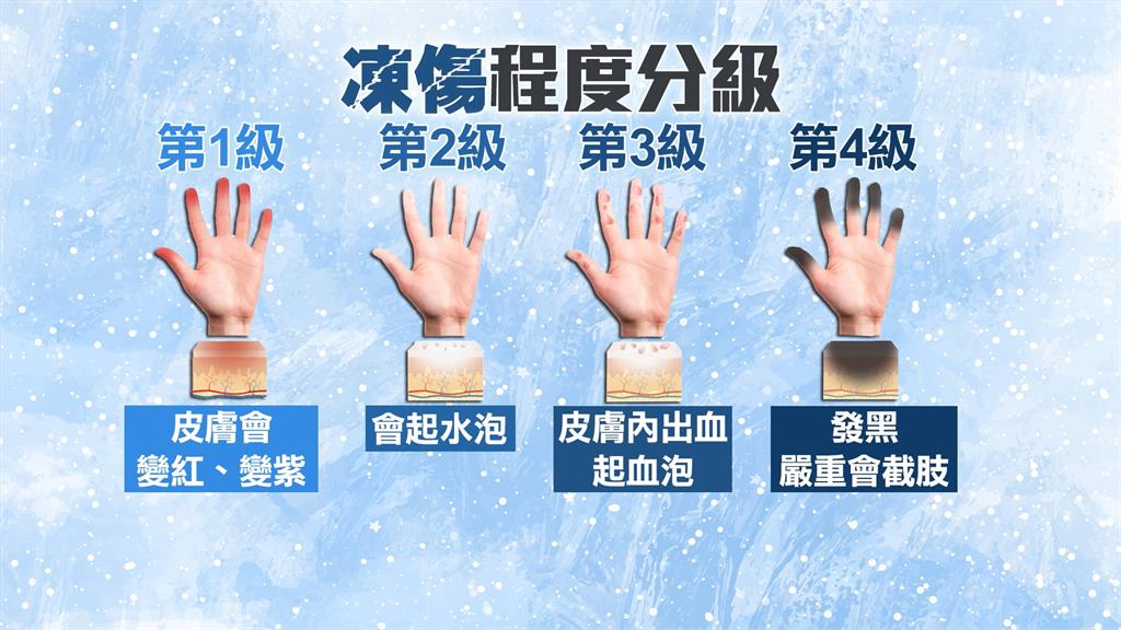 2025首波寒流來襲!春節「急凍5度」專家提醒:「2熱身方式」恐反效果