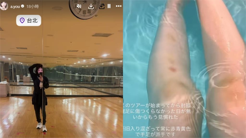 日本流行天后濱崎步睽違17年抵台 親曬「超赤裸入浴照」驚見小腿全是傷!