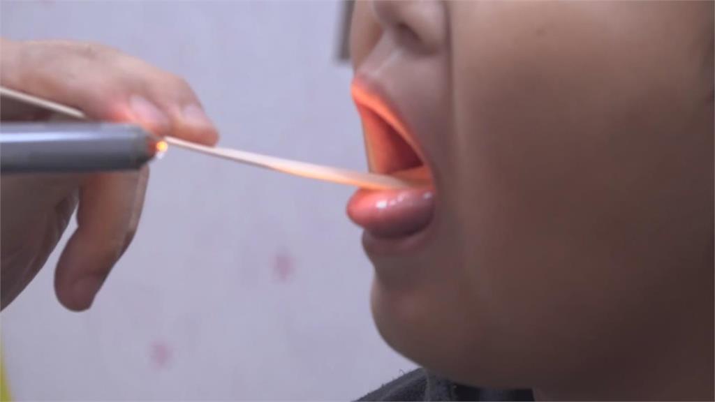 清明連假前爆首例「新冠變異株BA.3.2」!疾管署回應了…網慌:口罩要戴回來?