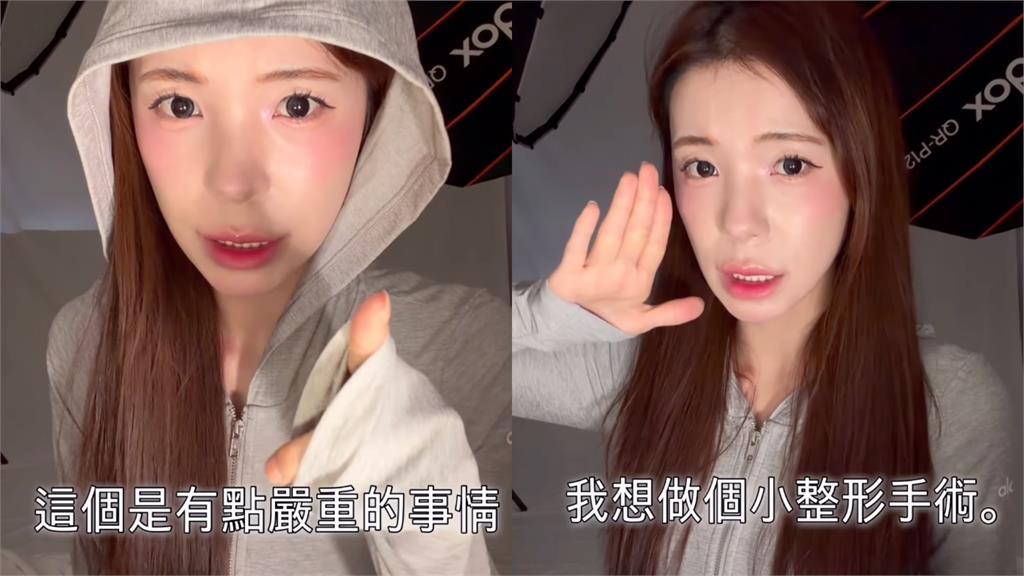 李多慧認了想動「第一次手術」！翻3年前舊照對比崩潰喊：真的超級嚴重