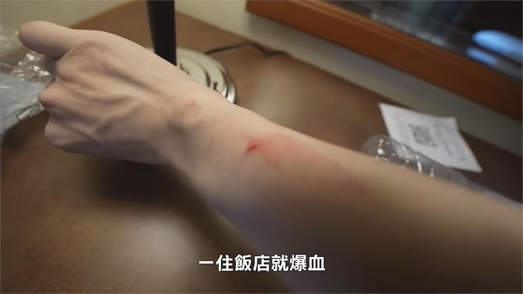入住泰國猛鬼飯店!他竟接通「無人撥打電話」 手臂還冒大片血痕