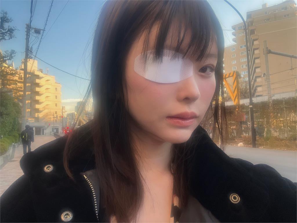 AV女神慘被牛郎前男友打成「獨眼龍」！昔「月燒千萬、斷連友人」心酸內幕曝