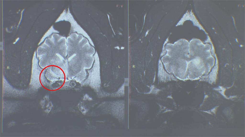不樂觀！「團團」MRI結果出爐　疑似腦瘤採「舒緩照護」照顧中