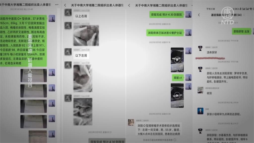 中國實習醫舉報活摘器官後離奇墜樓　電腦藏萬筆證據