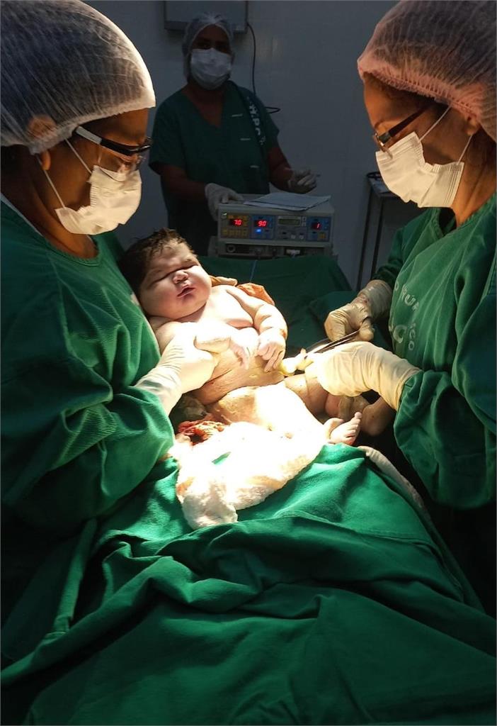 一胎抵兩胎！巴西誕7.3公斤超級巨嬰　竟是因母患「超常見疾病」