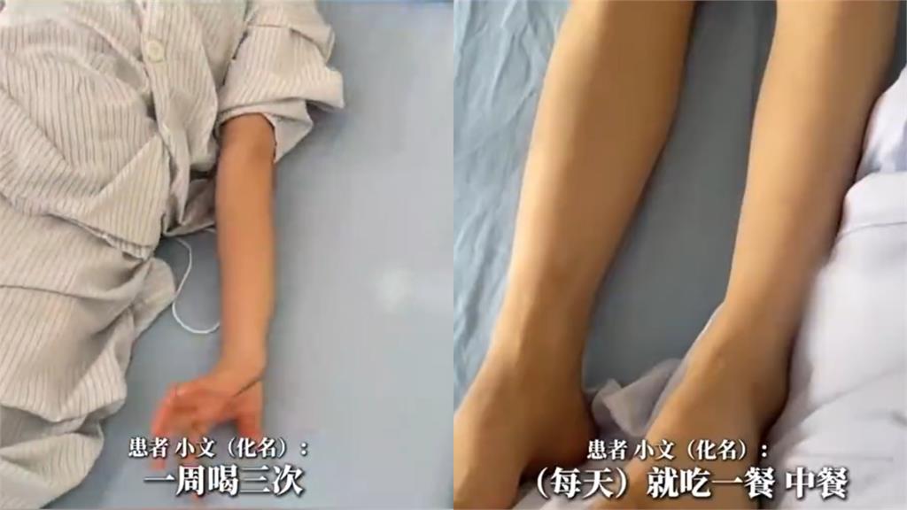 中國20歲女「把手搖飲當水喝」突瘋狂跳舞!竟罹「詭異怪病」醫揭恐怖真相