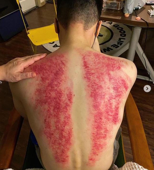 周湯豪攻蛋前驚曬「血紅翅膀」撕背痛炸!認了很氣自己:再這樣會倒下