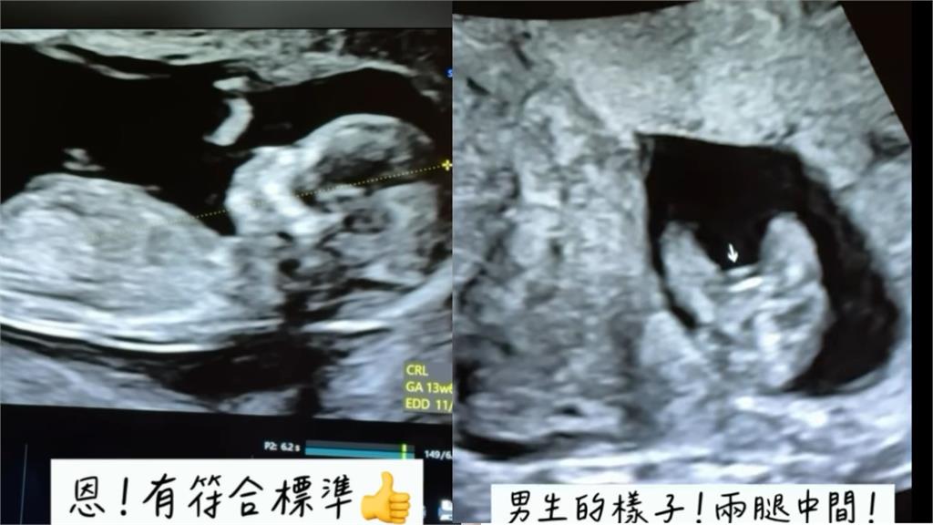 熊熊產檢二寶性別曝光!命理師「驚人預言全命中」她興奮喊:請受我一拜