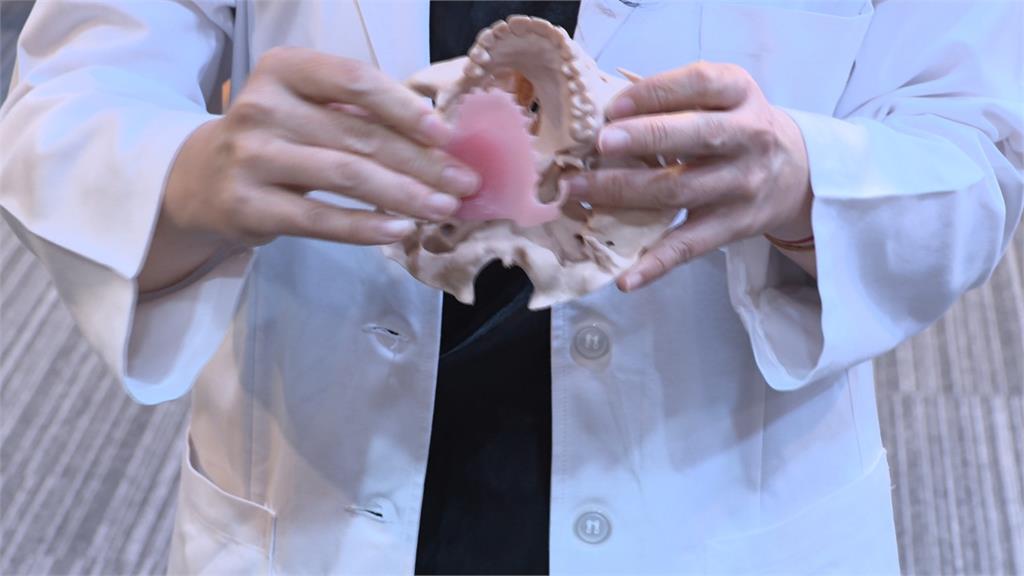 長庚3D列印製作「數位閉孔器」 助患者擺脫鼻胃管人生