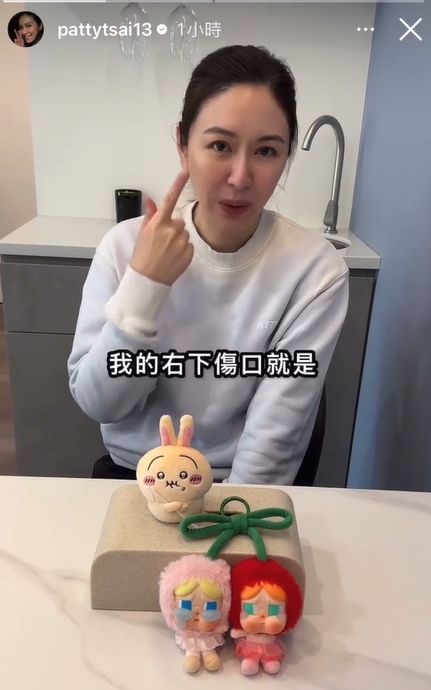 快新聞/PO受傷照嘆「該斷就斷」又刪文 蔡依珊擺「哭娃」喊:愛狗比較壯