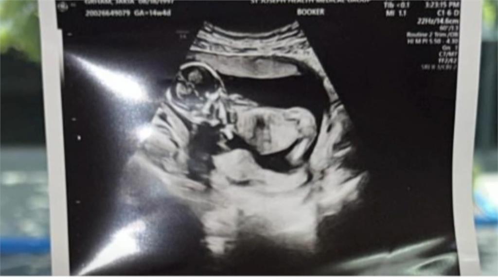 Po出代理孕母「無碼生產照」遭炎上　男同志遭起底是慈濟醫師