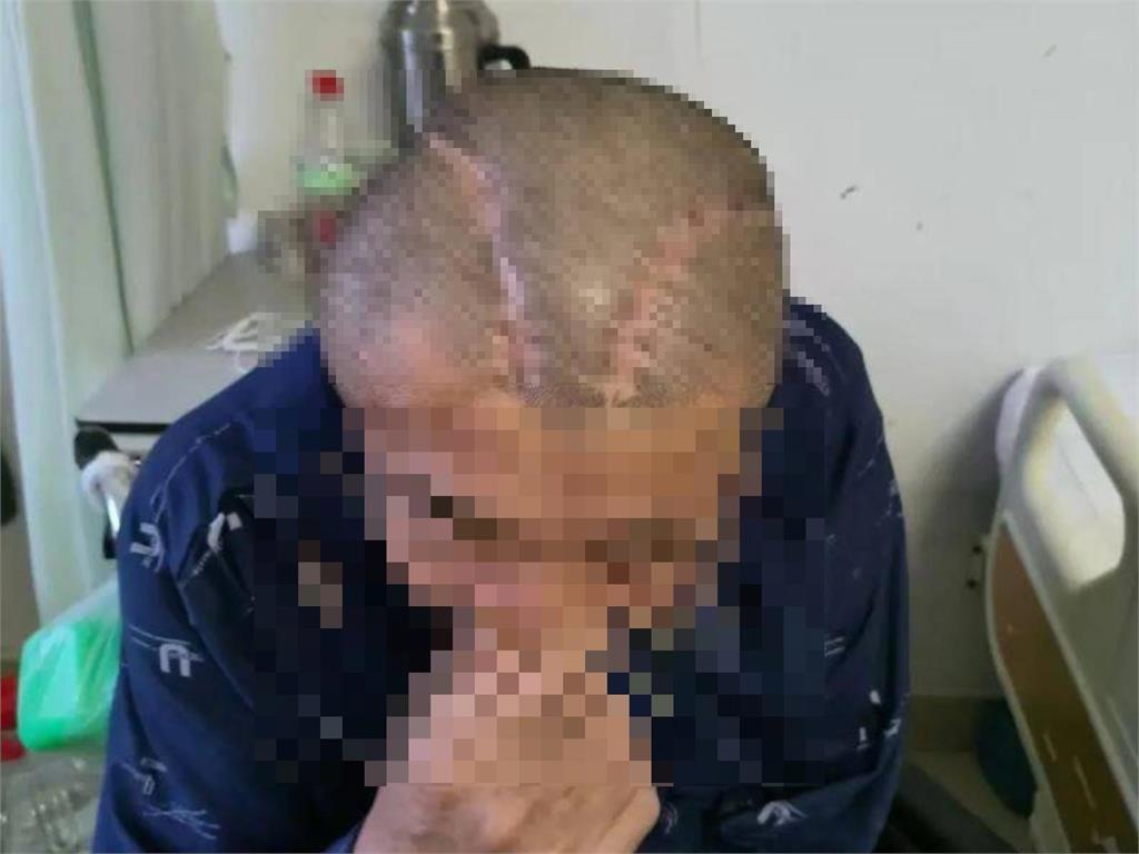 兩光「蒙古大夫」左右不分開錯刀！男腦出血變癱瘓「躺床3年」求償1400萬遭拒
