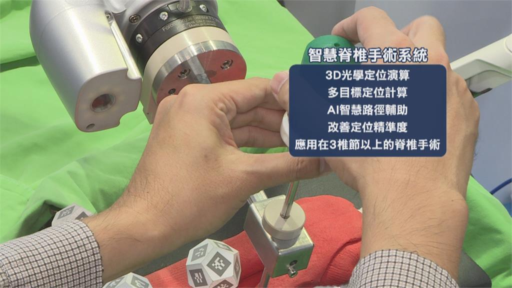 台灣醫療再躍進！　發表全球首款脊椎手術輔助系統   