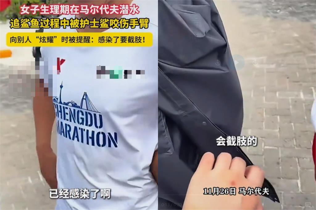 中國女飛馬爾地夫生理期下海遭「鯊魚狠咬手」！1態度挨轟：應該一口咬掉腦