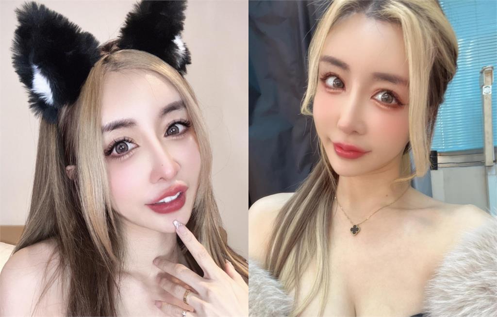 砸近千萬整型…雪碧又掰了「超假鼻子」！公開「術後拆線真面目」：還在腫