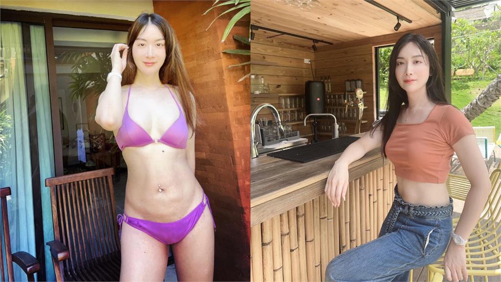 最美檢察官「6根肋骨骨折」現況曝!認了「動1手術」網驚:不給女人活