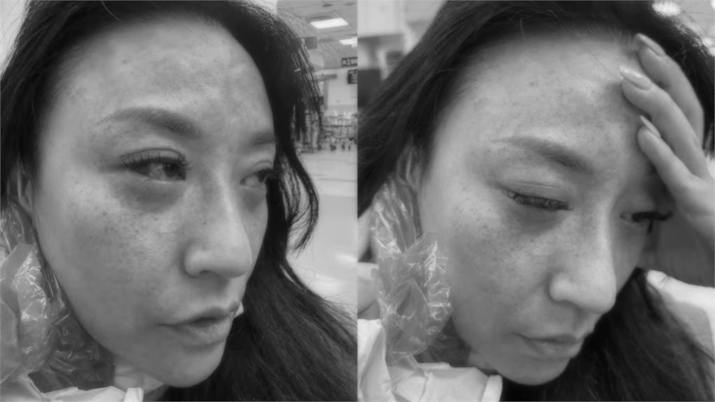 安歆澐突發不自殺聲明！公開遭尪勒脖「血管大爆裂」傷勢照：還是擔心被傷害