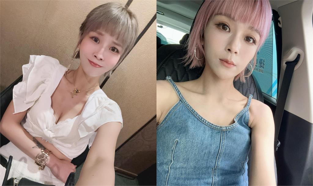 丟丟妹「93→46KG」被瘋傳切胃減肥!掀衣認了「肚子挖3洞」餓到睡不著