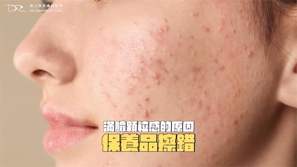 臉部顆粒感很重？醫指3主因釀粗糙感　指「用錯保養品」：角質代謝會異常