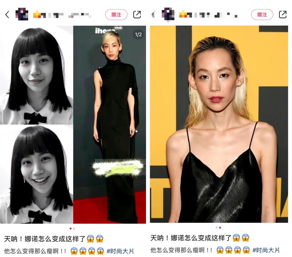《轉學來的女生》娜諾「眼神無光」又暴瘦!「整尊魔改」網驚呆:找錯人了?