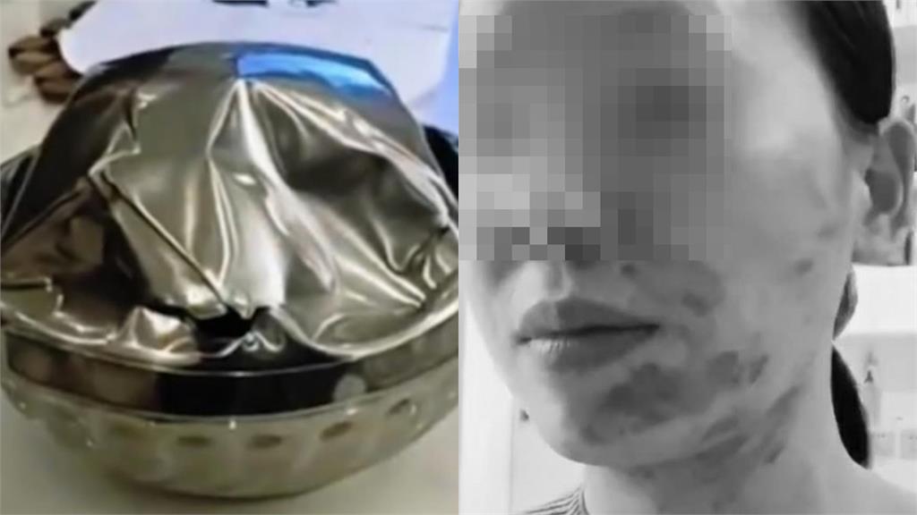 她下廚拿不鏽鋼碗裝突「炸裂變形」　慘遭「熱油飛濺潑臉」毀容畫面曝光！