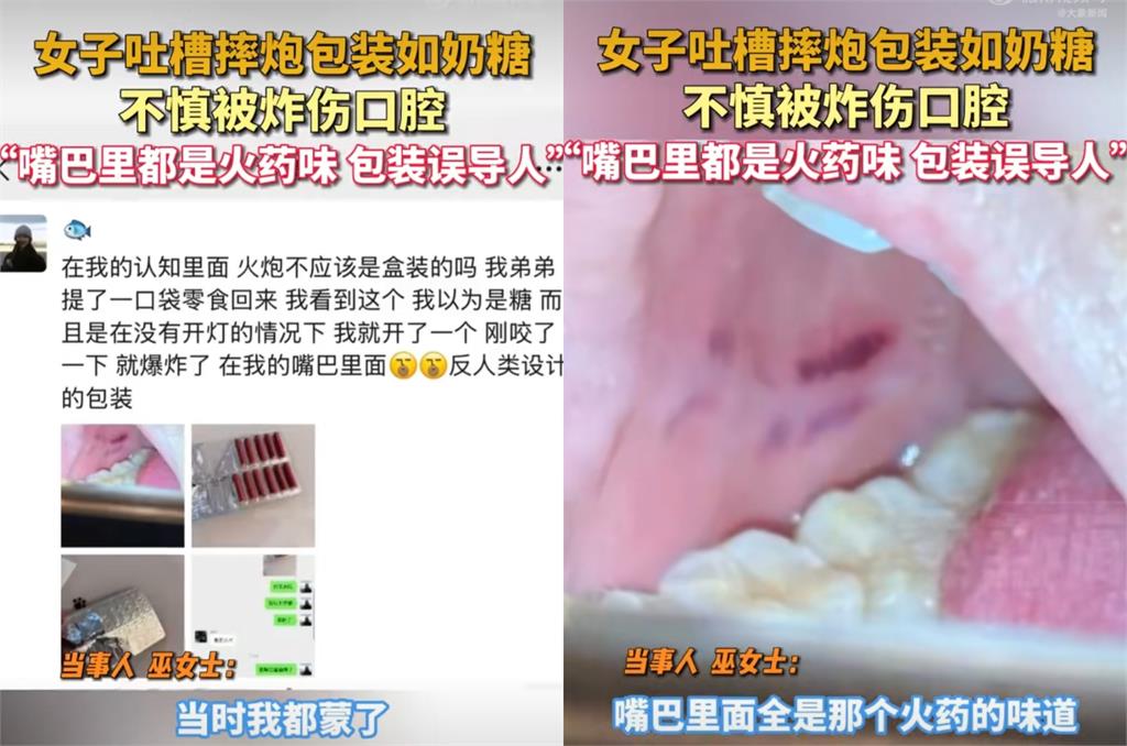 過年誤將甩炮認成牛奶糖！咬下瞬間「在嘴裡爆炸」網傻眼：包裝太易誤導