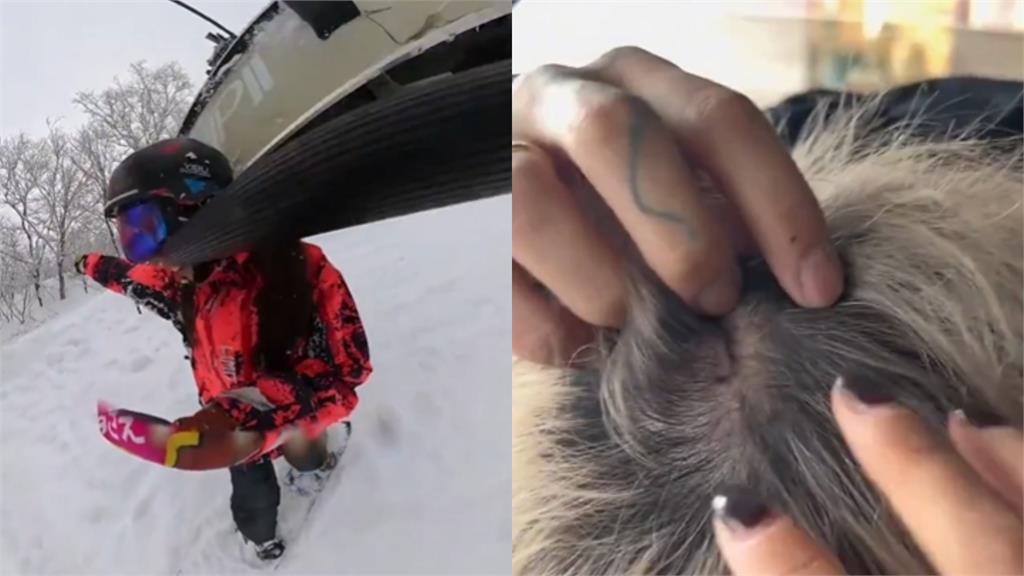 中國人赴日滑雪場被「纜車爆頭」畫面曝光！討拍不成…反被網打臉：活該