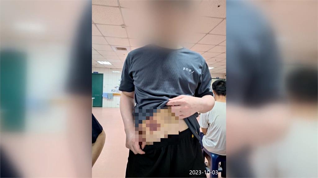 宏恩醫院遭被控護佐「毆打病患」　總院長：當事人互動都有情緒