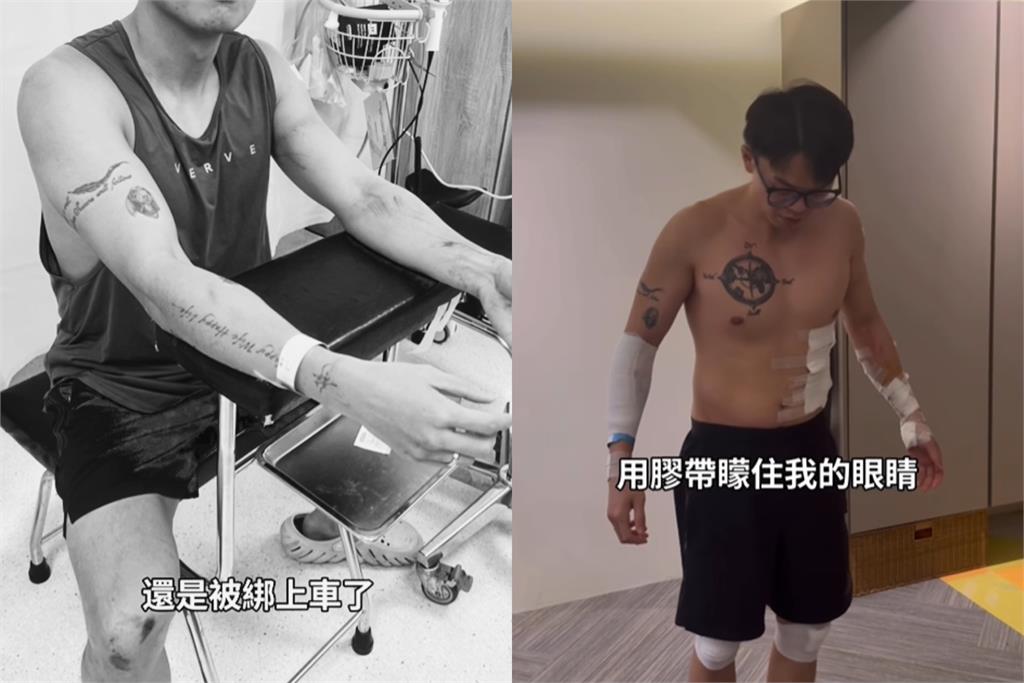 財經網紅遭綁架「戶頭532萬全被搶光」還被噴辣椒水黏雙眼！警逮2嫌1人仍在逃