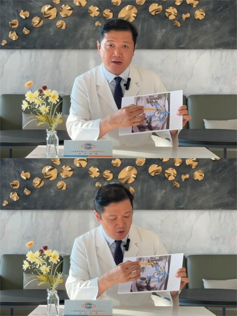 婦肛門劇痛半年只能臥床！驚見直腸後「罕見腫瘤」　醫曝：恐與遺傳肥胖相關