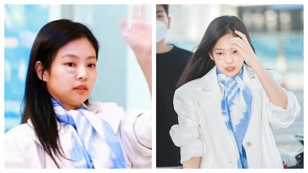 Jennie摔臉破相照流出！真面目崩壞「嚴重腫脹」網憂心：好可怕