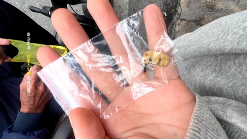 噁！　水煎包驚見「假牙」　店家：可能阿公自己的