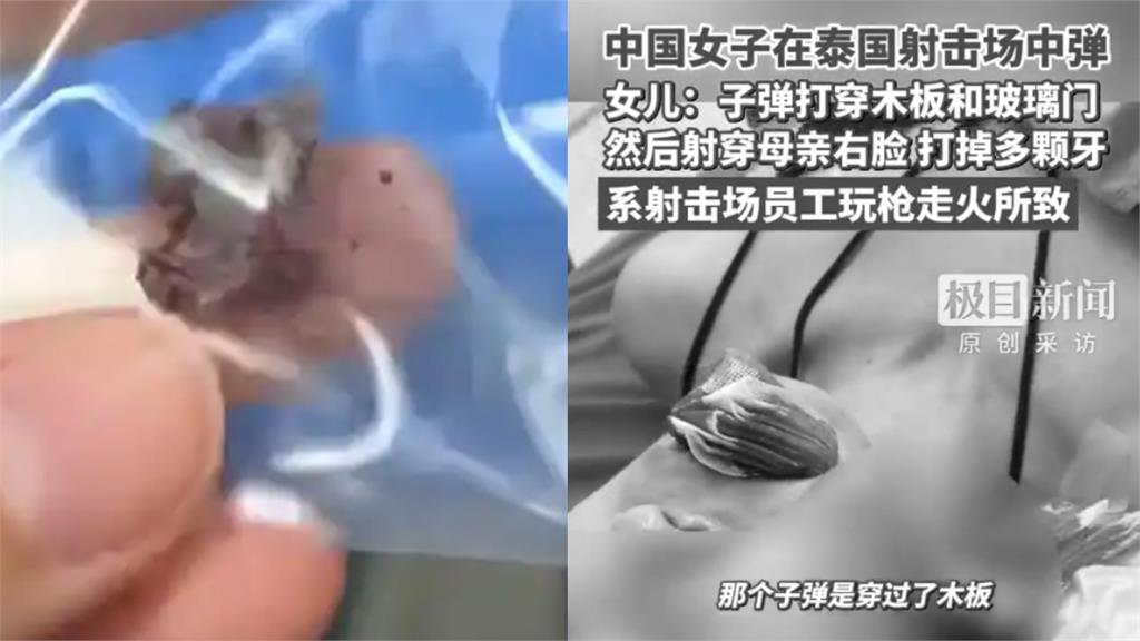 射擊場爆流彈意外!中國女遊客遭擊中臉部「子彈穿臉留黑洞」驚悚照片曝光