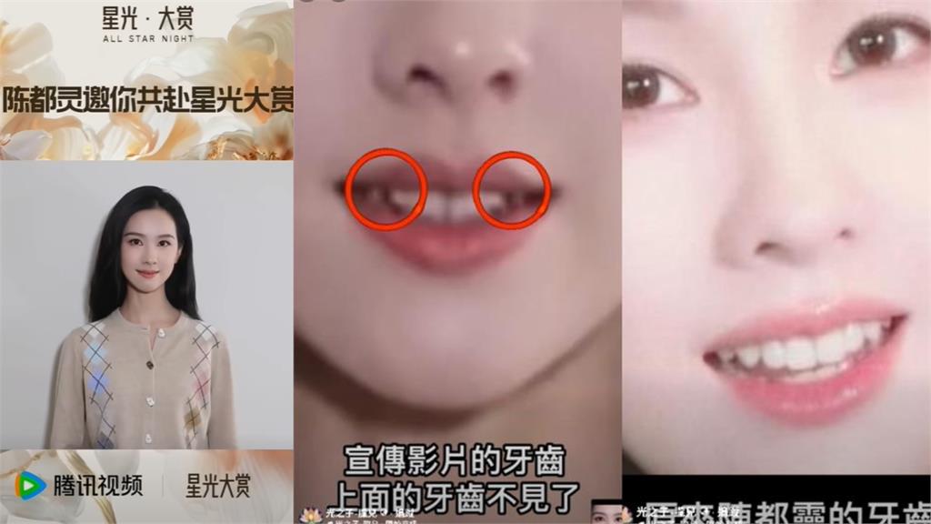 陳都靈爆「臉遭燒、被獻祭」牙齒消失