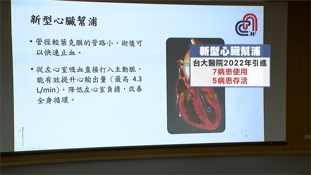 妙齡女因急性心肌炎險喪命 「新型心臟幫浦」救命新選項
