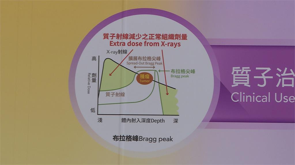 質子精準治療提升效能  造價數十億健保無給付