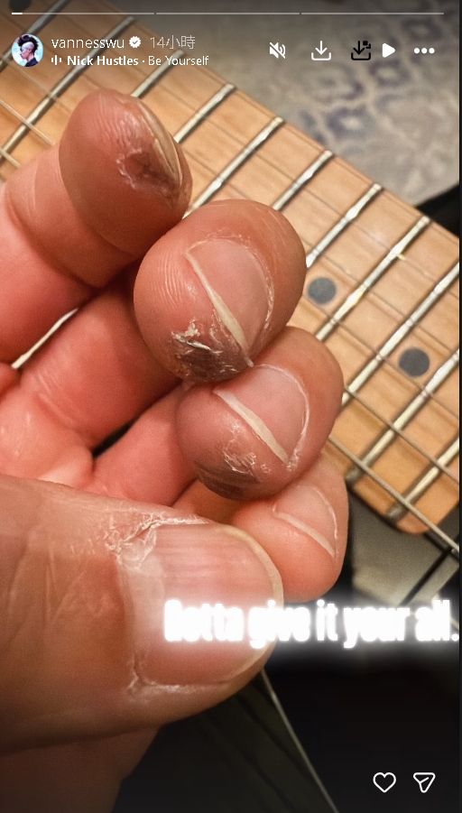 才傳暴瘦20公斤脫相!吳建豪再曬「手指傷勢照」粉絲嚇壞…周杰倫出手了