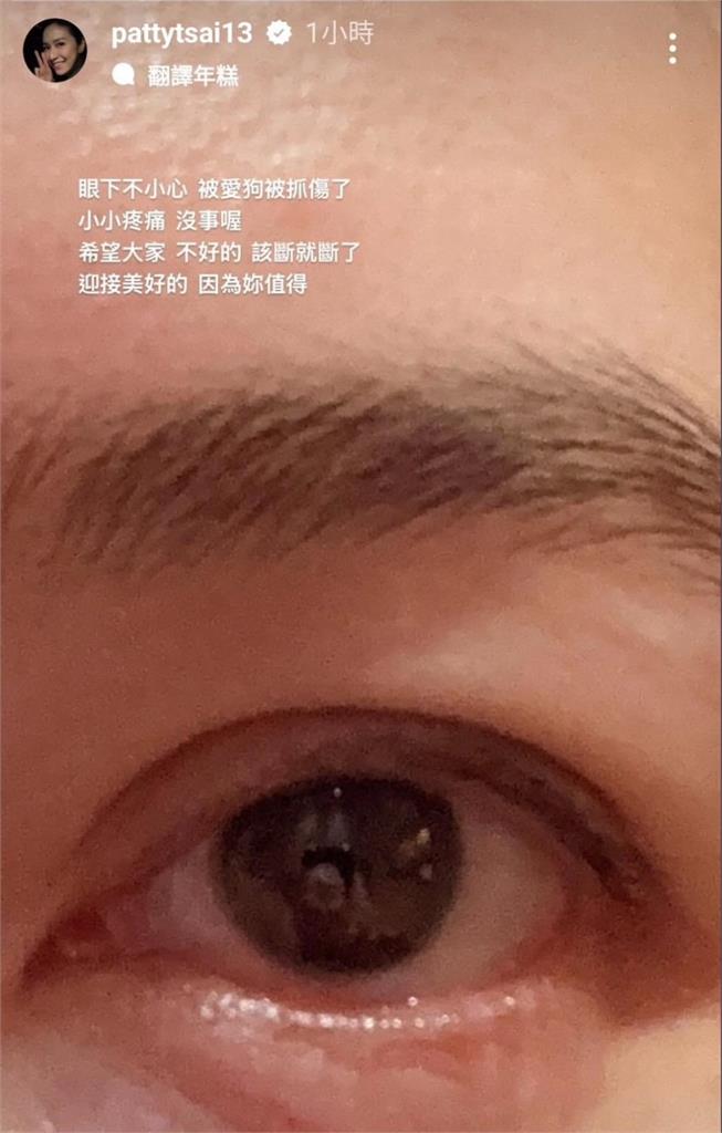 獨家/蔡依珊PO受傷照喊該斷就斷! 連勝文指「被小狗狗抓傷」:蠻心疼、蠻可憐
