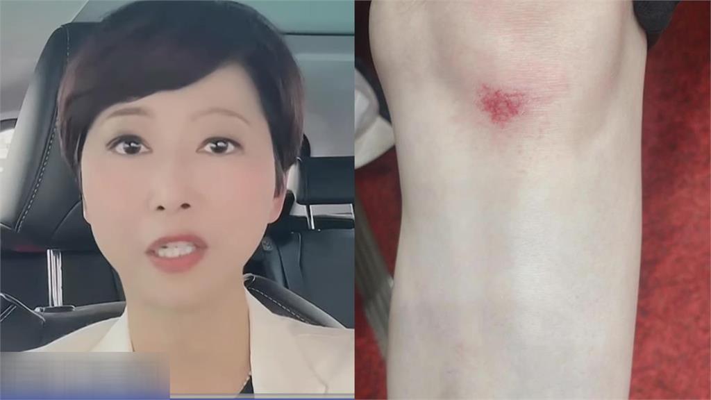 認了「故意踹倒陳亭妃」!徐巧芯囂張喊:不打你打誰 網怒:真的很歹毒