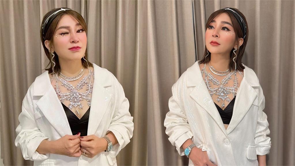王彩樺曝「醫美後遺症」玻尿酸燒20萬　泛淚喊話酸民「放過我吧、我都57歲了」