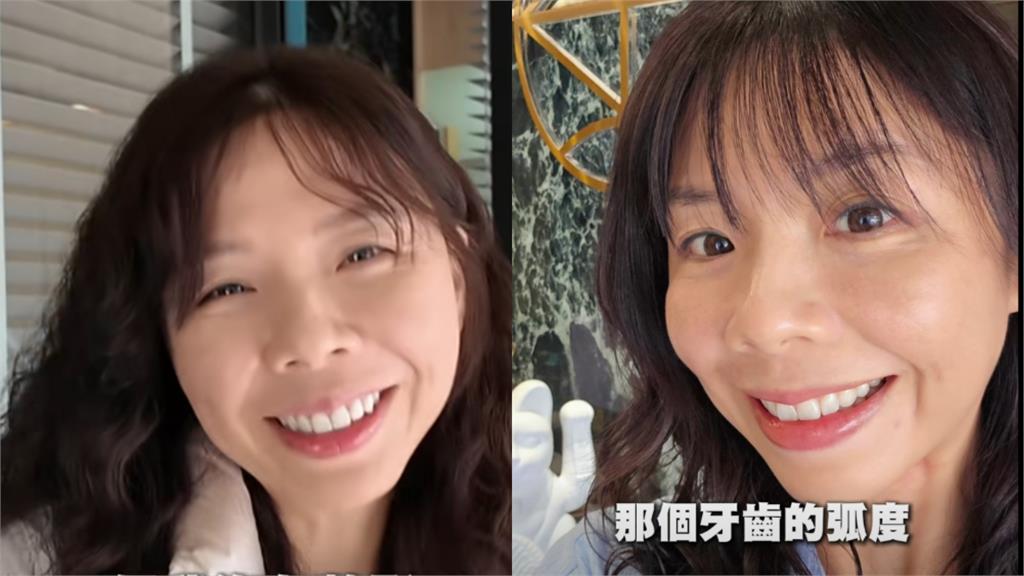 洪慈庸外貌大升級「判若兩人」認不出！遭媽猛問「整形嗎」本人親認了